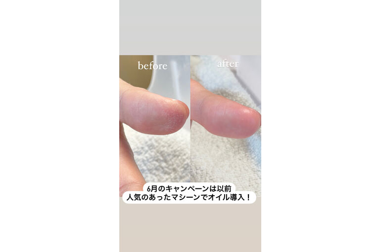 キャンペーン