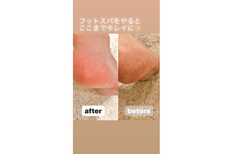 スパ