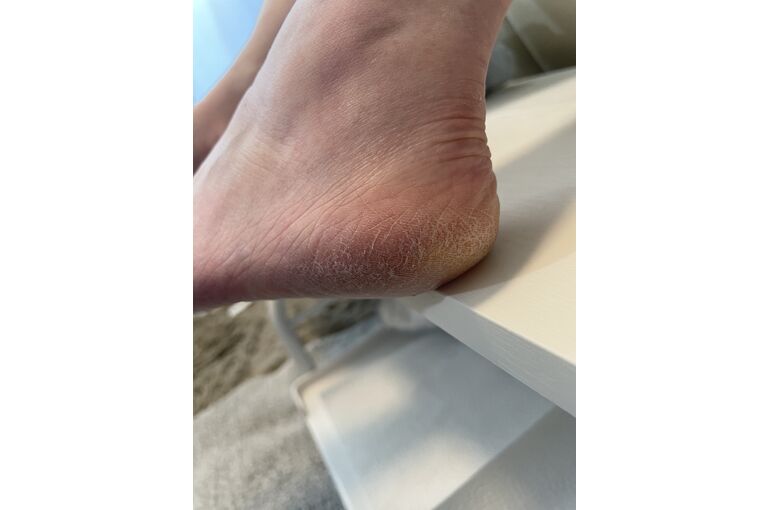 足裏ケア