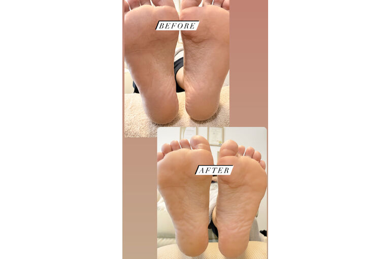 フットケア