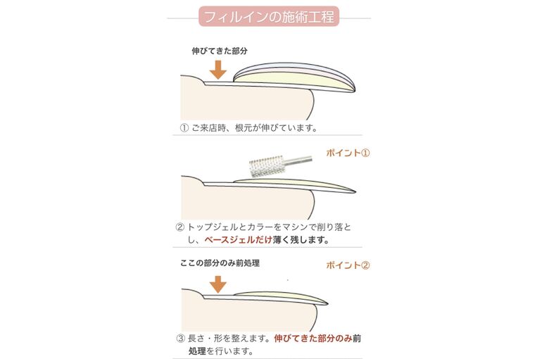 フィルイン